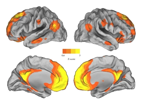 Brain Default Mode Network